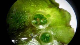 Liverwort Gemmae Cups [upl. by Acenahs]