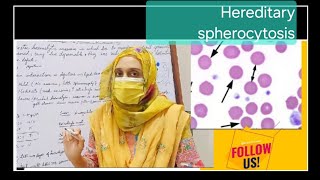 Hereditary Spherocytosis [upl. by Dinsmore707]