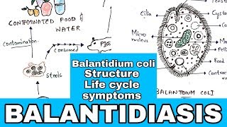 Balantidiasis  Balantidium coli Structure Life cycle Symptoms Medication  Bio science [upl. by Reema]