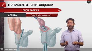 Urologia infantil criptorquidia refluxo vesicoureteral e fimose  Aula SarnarFlix [upl. by Ellette455]