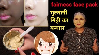 face pack for dark spots pimplesunburndarkness। multani mitti face pack for glowing skin। [upl. by Maxine726]