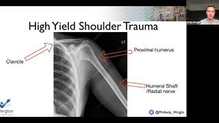 Shoulder FRCS orth revision Wrightington w BOTA [upl. by Nnagem]