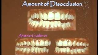 Determinants of Occlusal anatomy [upl. by Lunette]