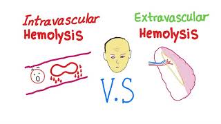 Intravascular Vs Extravascular Hemolytic Anemia Whats The ACTUAL Difference [upl. by Jessee]