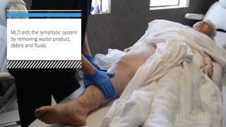 Manual Lymphatic Drainage MLD PostLipedema Surgery [upl. by Okechuku]