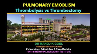 Thrombolysis vs Thrombectomy in Pulm Embolism [upl. by Roshan481]