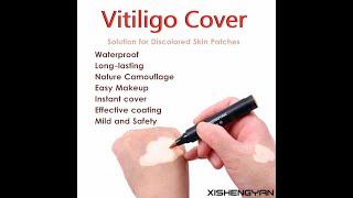 Coverage Waterproof Vitiligo Makeup Concealer Longlasting Camouflage Instant Makeup [upl. by Sacken685]