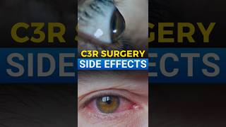 C3R Surgery Side Effects [upl. by Child]