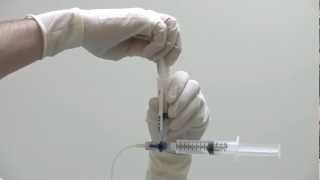 Injecting IntraVentricular Chemotherapy [upl. by Formenti]