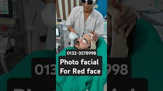 Red face laser treatmentlaser face treatmentlaal face ka treatmentdoctor [upl. by Publia651]