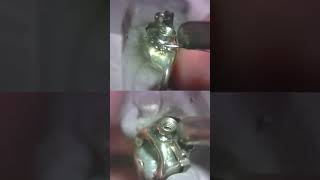 Welding a herbst appliance orthodontics ortholab ortho [upl. by Ttevy]