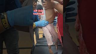 CP Child treatment drrajneeshkant chiropractor worldfamouschiropractor [upl. by Wilda]