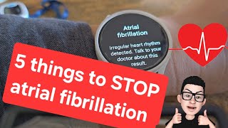 5 things Ive used to stop Atrial Fibrillation episode  AFib AF [upl. by Noskcaj]