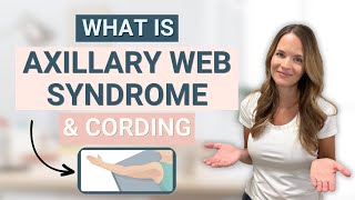 Axillary Web Syndrome or Cording  What is it [upl. by Vig]