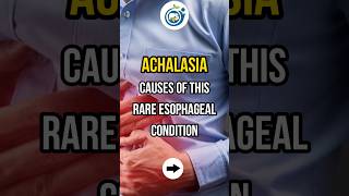 ACHALASIA CAUSES OF THIS RARE ESOPHAGEAL CONDITION shorts achalasia esophagus doctor [upl. by Hofstetter]