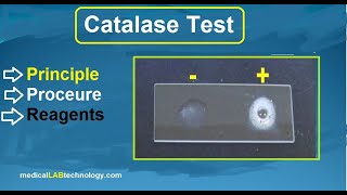 catalase test principle procedure microbiology  بالعربي labtech trendingshorts viralvideo [upl. by Novad]