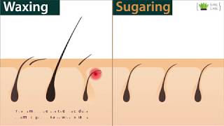 Waxing or Sugar Waxing which one is better [upl. by Analos230]