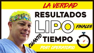 La VERDAD sobre la recuperación de una LIPOSUCCION y los RESULTADOS Lipo lipolaser lipoescultura [upl. by Enogitna]