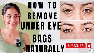 HOW TO REMOVE UNDER EYE BAGS NATURALLY  WHAT CAUSES UNDEREYE BAGS HOW TO GET RID OF UNDEREYE BAGS [upl. by Yadsnil911]