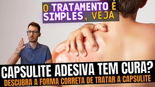 Capsulite adesiva O que causa e como tratar da forma correta Como recuperar o movimento do ombro [upl. by Bradan]