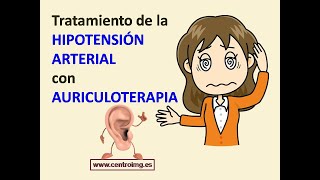 82 Cómo tratar la HIPOTENSIÓN ARTERIAL Curso de Auriculoterapia Centro IMG [upl. by Nedgo]