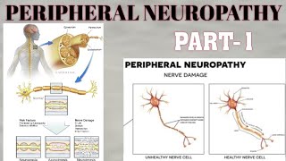 PERIPHERAL NEUROPATHY  PART1  WALLERIAN DISTAL AXONAL DEGENERATION amp SEGMENTAL DEMYELINATION [upl. by Karleen]