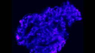 Calcium efflux fluo3 from a glomerulus Ionomycin [upl. by Elfrieda]