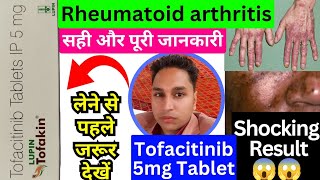 tofacitinib 5 mg tablet hindi  tofacitinib tablets 5mg  tofatas tablet 5 mg  tofakin tablet [upl. by Serica]