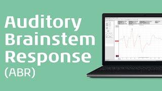 Auditory Brainstem Response ABR An Introduction [upl. by Keeley734]