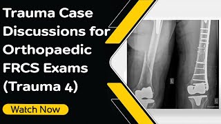 Trauma Case Discussions for Orthopaedic FRCS Exams Trauma 4  Orthopaedic Academy [upl. by Emelda]