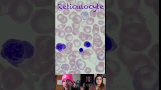 Reticulocyte Morphological Characteristics [upl. by Burton]