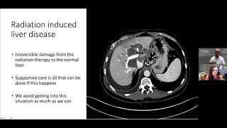 Webinar Radiation therapy and molecular characterization of cholangiocarcinoma [upl. by Lered131]