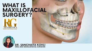 What is Oral and Maxillofacial Surgery Dr Sanchaita Kohli  RG Aesthetics [upl. by Auhsuj607]