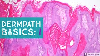 Basic Dermpath Cases  Explained by a Dermatopathologist [upl. by Anen]