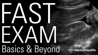 FAST Exam Basics amp Beyond [upl. by Rebmac76]