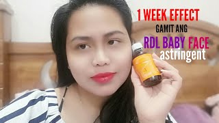 RDL BABY FACE ASTRINGENT in 1 WEEK update [upl. by Niala]