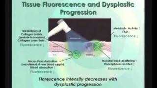 Velscope Cancer Screening 4 of 5 [upl. by Brice]