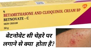 BETNOVATEC Cream  Use  How To Apply  Precautions  Side Effects  PRICE [upl. by Couhp]