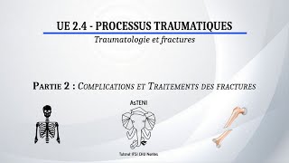 UE 24 S1  Les fractures  Complications et traitements Partie 22 [upl. by Gilboa770]