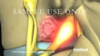 Nucleus Spine Demo Reel 2010 [upl. by Irroc337]