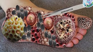 ASMR Infected Foot Treatment Animation Dog Tick amp Maggot Removal  Deep Cleaning Animation [upl. by Nnayt]