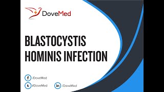 Blastocystis Hominis Infection Blastocystosis Symptoms and Causes  Diagnosis  Treatment [upl. by Lydon242]