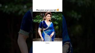 When plastic surgery goes right 🥰 urvashirautela bollywood beauty bollywoodmusic bollywoodsongs [upl. by Mharba436]