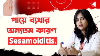 পায়ে ব্যথার অন্যতম কারণ Sesamoiditis [upl. by Letnuahc]