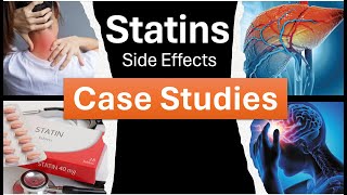 Statin Side Effects Case Studies [upl. by Oliva]