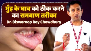 मुँह के घाव को ठीक करने का रामबाण तरीका  Dr Biswaroop Roy Chowdhury [upl. by Enelloc499]