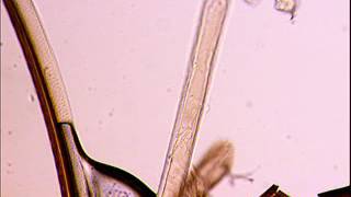 ​Trypanosoma congolense in the tsetse proboscis [upl. by Sutherland]