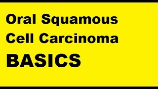 Oral squamous cell carcinoma  Basics [upl. by Areht]