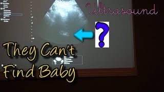 8 Weeks Pregnant Ultrasound  Cant Find Baby  Scared [upl. by Frey752]