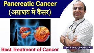 Pancreatic Cancer Treatment  अग्नाशय में कैंसर का इलाज  Homeopathic Treatment of Cancer [upl. by Maris]